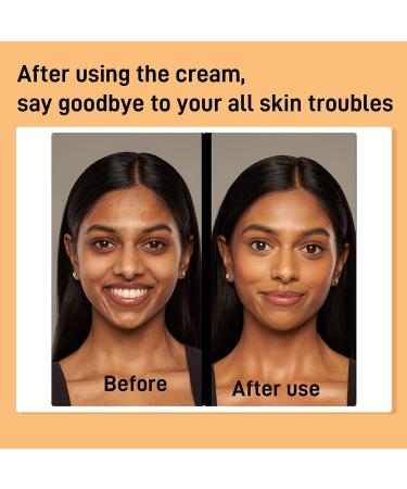 Turmeric Kojic Acid Face Cream- Natural Turmeric Skin Brightening Lotion for Face & Body Anti-Aging Cream Turmeric Face Moisturizer for Dark Spots Dry Skin Hydrating Firming Even Tone - Buy Online on SooperMarket.com