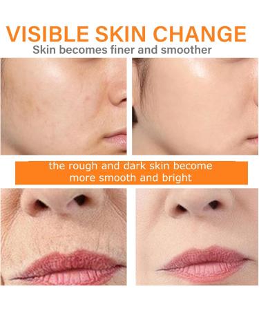 Turmeric And Vitamin C Face Serum Dark Spot Corrector Serum Turmeric Anti Aging Face Serum For Women Hydrating Serum Serum Face Oils Face Moisturizing Reduce Wrinkles Dark Spots For Body &Face - Buy Online on SooperMarket.com