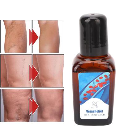 Varicose Vein Treatment Spray & Serum - 2 x 20ml for Spider Veins Relief | Effective Vein Care Cream - Buy Online on SooperMarket.com