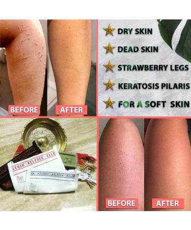 Kelebek Turkish Hammam Kese Exfoliating Glove | Dead Skin Cleanser & Body Scrub | Skincare Kit for Soft Skin | Women & Men - Buy Online on SooperMarket.com