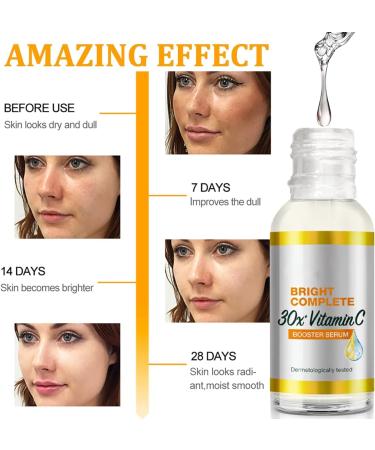 Shefave Vitamin C Serum for Face - Dark Spot Remover - Face Serum with 30x Vitamin C and Hyaluronic Acid - Anti-Dark Spot Serum - Fading Dark Spots for Tired Pale Skin - Buy Online on SooperMarket.com