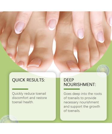 Nail Nourishing Solution | Multifunctional Nail Repair Drops | Nail Strengthening Drops | Hydrating Nail | Natural Nail Repair Remedy |-Infused Nail - Buy Online on SooperMarket.com