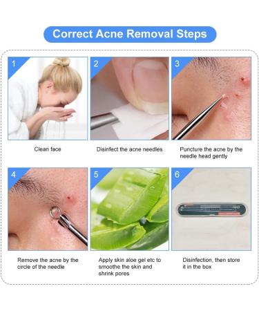 4PCS Blackhead Remover Tool Set for Acne, Comedone, Pimples, Spot, and Zit Extraction - Buy Online on SooperMarket.com