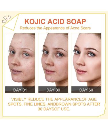 2 x 65G Peak Light Kojic Acid Skin Lightning Soap Face Bar - Targets Dark Spots, Acne, and Red Scars - Highest Grade Formula - Buy Online on SooperMarket.com