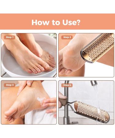 Professional Foot File Scrubber Pedicure - Callus Remover for Feet | Easkep Foot Grater Rasp Scraper for Corns and Dead Skin (Golden) - Buy Online on SooperMarket.com