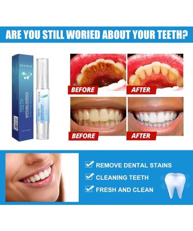 Teeth Whitening Essence & Gel | Herbaluxy Tooth Whitening Pen - Effective Stain Removal | Premium Oral Care - Buy Online on SooperMarket.com