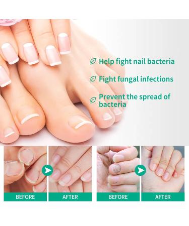 2Pack Kerassentials Toenail Oil and Skin Treatment Set for Nail Care - Buy Online on SooperMarket.com