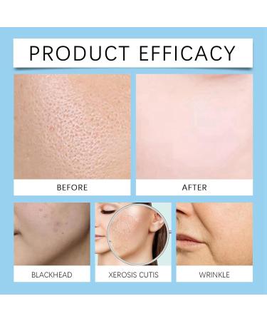 Gla-Mory Micros-Infusions System for Lips Gla-Mory Micro-Infusions System for Face Face Serum Hyaluronic Acid Gla-Mory Facial System with Serum Hydrating Serum for Women Smooth Skin Facial Serum 10ml - Buy Online on SooperMarket.com