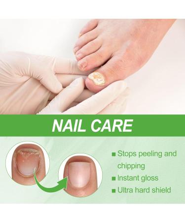 Keratin 3 Day Growth Nail Treatment & Strengthener - Nail Strengthener for Damaged Nails Thin Nails - Nail Growth Treatment for Nail Strengthener - Fast Keratin Nail Hardener - Buy Online on SooperMarket.com