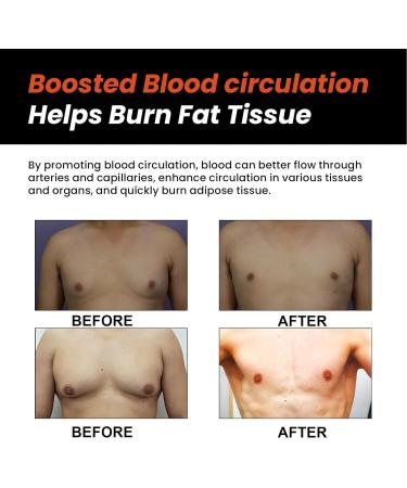 Joint Pain Relief & Gyn komastie Reduction Soap Set - Body-Shaping Cellulite Treatment for Men - Circulating Coal Soap for Abdominal Tuck - Buy Online on SooperMarket.com