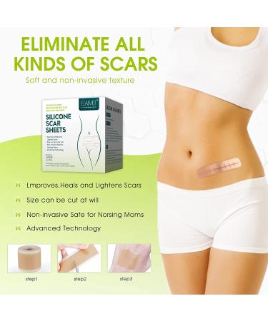Soft Silicone Scar Tape Roll 1.6x 120 (8 Month Supply) | Reusable & Effective Scar Removal for C-Section, Keloid Surgery, Burn & Acne - Buy Online on SooperMarket.com