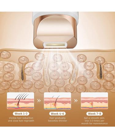 Aopvui IPL Laser Hair Removal Device for Women & Men - At-Home Whole Body Hair Remover | International Shipping Available - Buy Online on SooperMarket.com