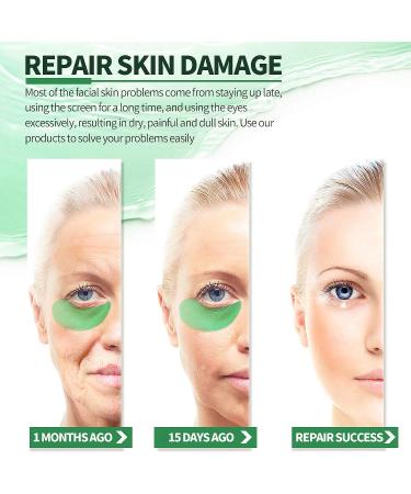 30 Pairs Hyaluronic Acid Under Eye Patches - Anti-Aging Gel Masks for Dark Circles Puffiness & Fine Lines - Collagen Eye Treatment (Green - Buy Online on SooperMarket.com