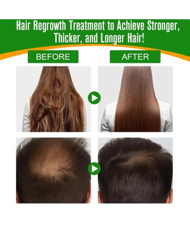 JCZQDRPC Batana Oil for Hair Growth & Skin Care | 100% Pure Essential Oil - 60ml for Hair Eyebrows & Eyelashes - Buy Online on SooperMarket.com