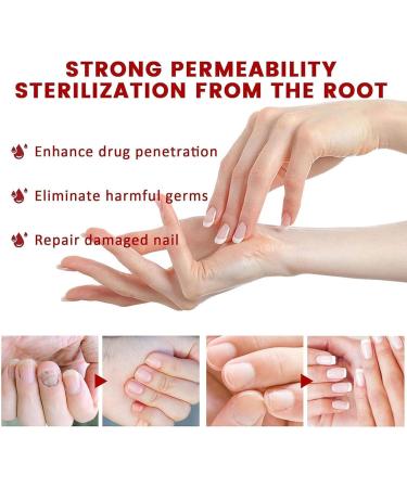 Nail Oil Cuticle 30ml with Herbal Extract Cuticle Oil for Nails Jojoba Nail Cuticle Oil Nail Oil Soothe Moisturize with Dropper Design for Dry Rough Nail Care Repair - Buy Online on SooperMarket.com