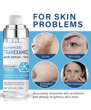 Buy Tranexamic Acid Serum - Discoloration Correcting Face Lotion | Natural Moisturizing Skincare | International Shipping - Buy Online on SooperMarket.com