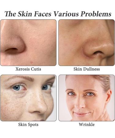 Hyaluronic Acid 2% + B5 30ML Hyaluronic Acid Serum for Face Dark Spot Remover for Face Hyaluronic Acid Face Moisturize Skincare Serum for Face to Plump and Smooth Skin for All Skin Types Skin Care - Buy Online on SooperMarket.com