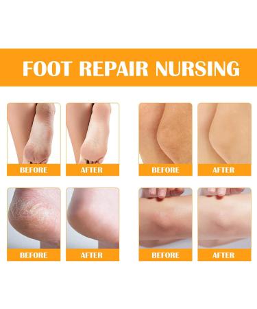 Foot Peeling Spray Instant Foot Peeling Spray Foot Spray to Remove Dead Skin Hydrating Nourish Peel Off Spray Exfoliating Peeling & Calluses on Feet for Cracked Rough Heels (1PCS Orange) 1 count (Pack of 1) Orange - Buy Online on SooperMarket.com