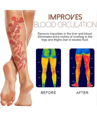 RGVai 5 PCS Mediginger Antiswelling Lymphunclog Ointment - Gingerlegs Anti Swelling Detoxing Ointment - Buy Online on SooperMarket.com