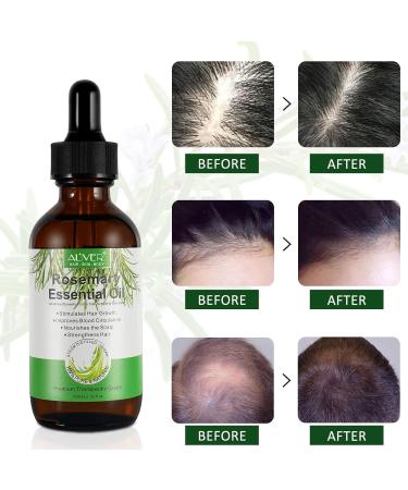 Rosemary Oil for Hair Growth & Loss Regrowth Treatment - 2.02 oz | Strengthens, Nourishes Scalp, Improves Circulation - Men & Women - Buy Online on SooperMarket.com