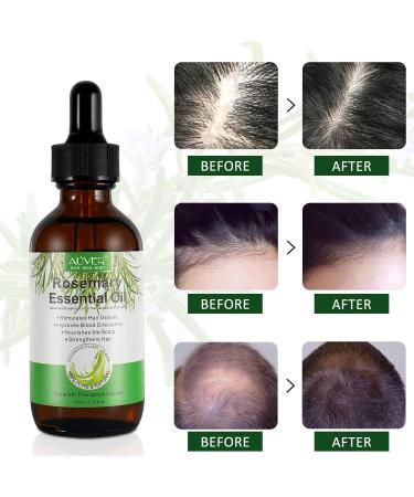 100% Pure Rosemary Oil for Hair & Scalp - 60ml | Natural Hair Growth Nourishing & Aromatherapy - Buy Online on SooperMarket.com