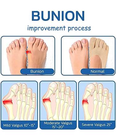 LSNTUU Orthopedic Bunion Relief Socks for Women - Toe Compression Sock | Bunion Corrector (White, 3 Pair) - Buy Online on SooperMarket.com
