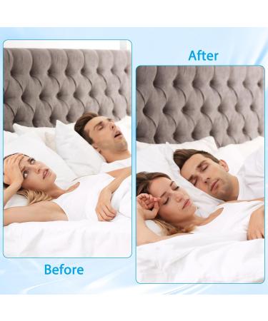 Anti Snoring Devices for Sleep Anti Snoring Mouthpiece Anti Snoring Mouth Guard Stop Sleeping Snore Snoring Solution - Buy Online on SooperMarket.com