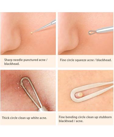 Blackhead Remover Tool Kit - FEITA Acne Pimple Tweezers Comedone Extractor Blemish Removal Tool Set for Facial Whitehead Popping Zit Removing - Buy Online on SooperMarket.com