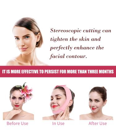 Facial Lifting Slimmer V-Line Mask & Double Chin Belt - Neck Compression Skin Care Wrap (Pink) for Effective Weight Loss - Buy Online on SooperMarket.com