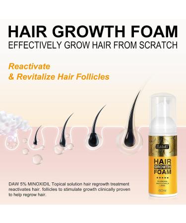 5% Minoxidil Foam Hair Regrowth Treatment for Men & Women - Stops Hair Loss, Promotes Follicle Growth - 2.11fl oz - Buy Online on SooperMarket.com