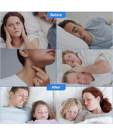 120 Pcs Advanced Gentle Mouth Tape for Nose Breathing | Stop Snoring and Mouth Breathing During Sleep - Buy Online on SooperMarket.com