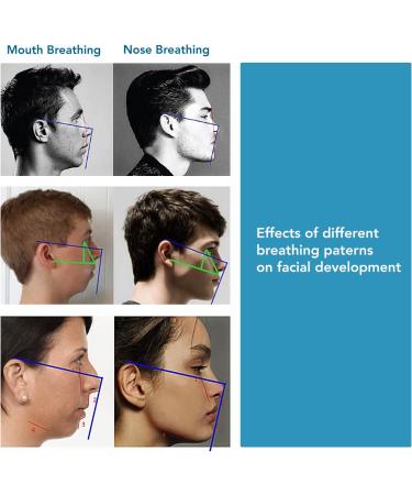 Advanced Mouth Tape for Sleep | 90 PCS | Stop Mouth Breathing | Gentle Tape for Better Nose Breathing - Buy Online on SooperMarket.com