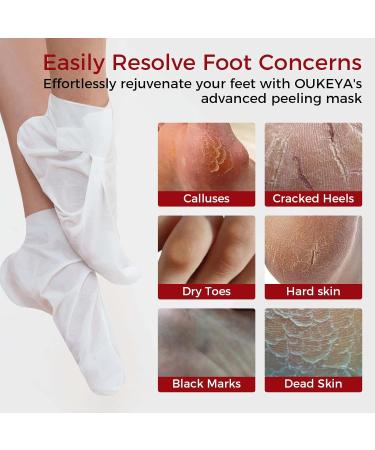 OUKEYA Foot Mask 3 Pairs: Nourish Foot Mask Dermatologically Tested Repairs Heels & Soften Dry Dead Skin for Cracked Feet(No Peeling) Rose - Buy Online on SooperMarket.com