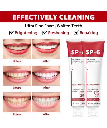 SP-6 Probiotic Whitening Toothpaste - Ultra Whitening & Deep Cleaning - Brighten Your Smile - Buy Online on SooperMarket.com