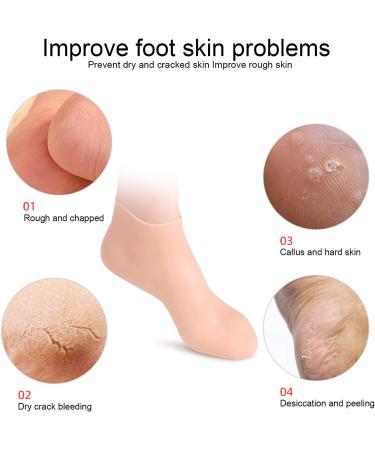 Buy Angrek Anti-Cracking Socks - 2 Pairs Moisturizing Foot Care Socks for Soft Heels (Size S 33-35) - Elastic Foot Protection - Buy Online on SooperMarket.com