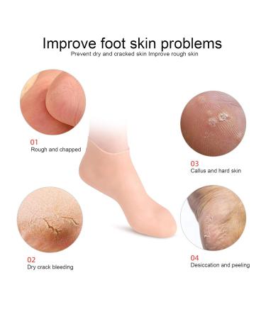 Elastic Foot Care Socks - Moisture-Wicking SEBS Material (2 Pairs XL 42-44) | International Shipping Available - Buy Online on SooperMarket.com