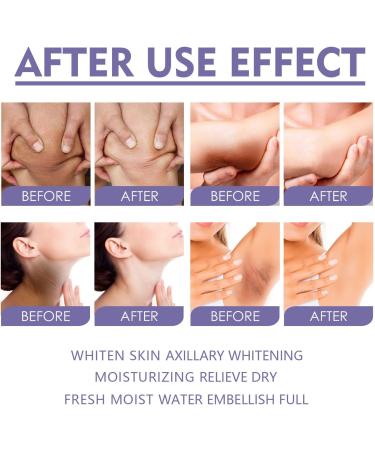 Dark Spot Corrector Stick Ordor Removal Moisturizing Armpit Whitening Cream with Centella Asiatica Extract for Elbows and Knees - Buy Online on SooperMarket.com