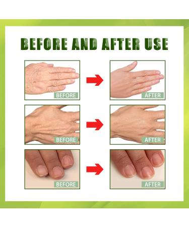 Hands Moisturizing Mask - Ultimate Hand Care for Whitening & Dry Skin Relief | Hydrating Skin Care Treatment - Buy Online on SooperMarket.com