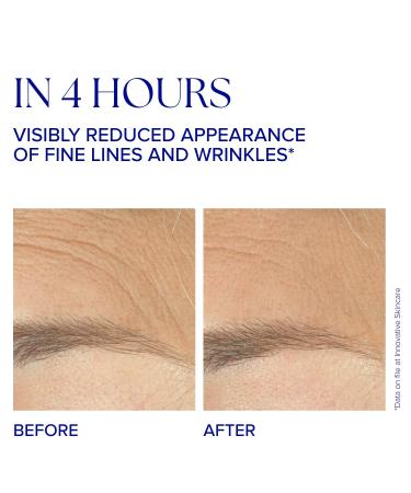 IS CLINICAL Youth Complex - Anti-Aging Serum for Collagen Boost & Firm Skin | Ultimate Wrinkle Reducer - International Shipping - Buy Online on SooperMarket.com