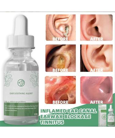 Wuwuhen Arsicor Organic Herbal Drops - Ear Soothing Agent for Tinnitus Relief - Buy Online on SooperMarket.com