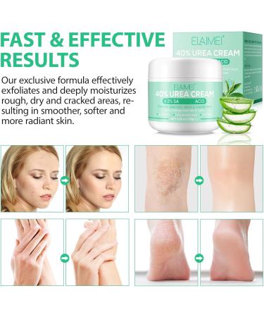 Urea Foot Cream Ultra Moisturizing 40% Urea Foot Cream Plus Deeply Hydrating Heel Balm For Callous Removal and Soften For dry Cracked Feet Heels and Hands - 100g 100 Grams - Buy Online on SooperMarket.com