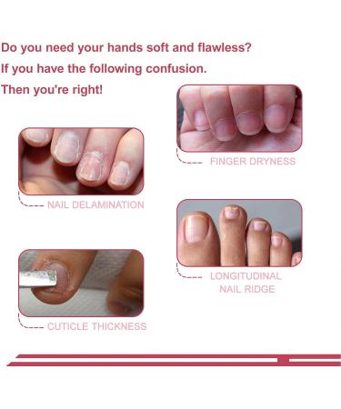 Nail Cuticle Remover Kit Hydrate Exfoliating Powered Cuticle Remover Kit for Travel Use (LS152-3) - Buy Online on SooperMarket.com