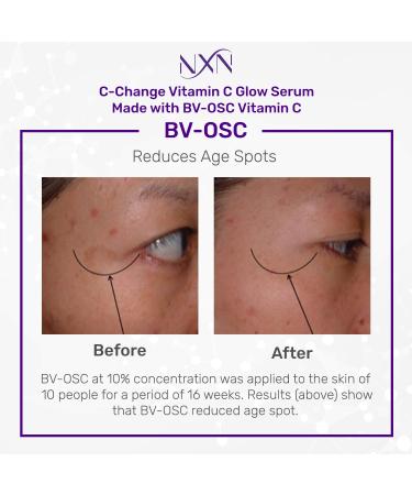NxN Vitamin C & Hyaluronic Acid Serum Set for Brightening Skin, Dark Spot Reduction, and Anti-Aging - 1fl oz Face Kit - Buy Online on SooperMarket.com