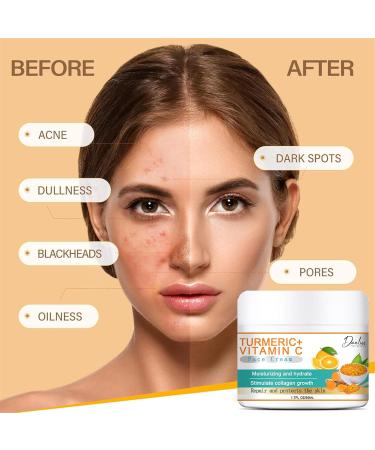 Vitamin C Face Cream - Vitamin C Cream with Hyaluronic Acid 50ml - Face Moisturiser to Nourish Skin - Smooth Lines & Boost Glow - With Vitamin C and Super Citrus For Radiant - Healthy Skin - Buy Online on SooperMarket.com