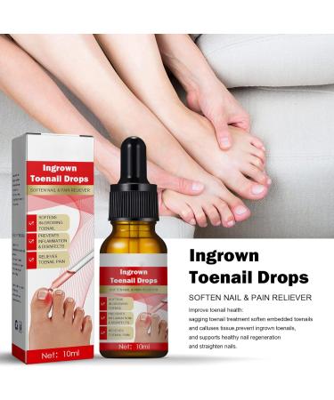 Ingrown Toenail Treatment Oil - Natural Solution for Ingrown Toenails & Fungal Nail Care | 1PCS - Buy Online on SooperMarket.com