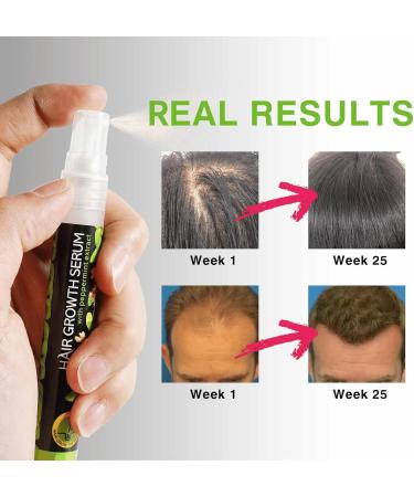 Hair Regrowth Spray Hair Growth Serum for Men & Women Anti Hair Loss Spray with Mint and Ginger Hair Rapid Growth Spray Repair Hair Follicles Hair Regrowth Serum for Bald Spots & Thinning Hair - Buy Online on SooperMarket.com