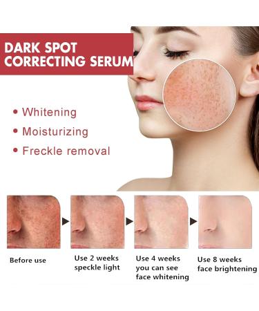 Trendyfave Dark Spot Serum Niacinamide Serum Brightening Serum 10% Niacinamide+ 4% Tranexamic Acid Dark Spot Corrector For Face Age Spot Remover For Face Face Redness Remover Arbutin Serum - Buy Online on SooperMarket.com