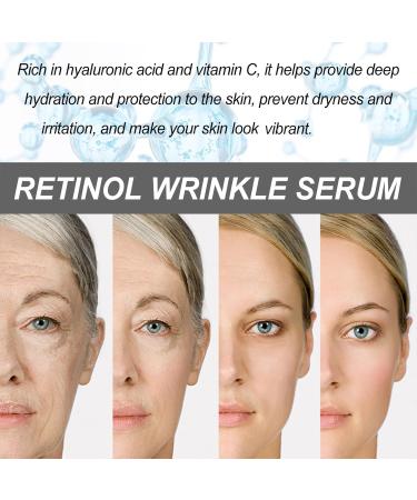 Japan Retinol Serum - 0.4% Retinol & Hyaluronic Acid | Anti-Aging Face Serum for Women & Men | Reduce Fine Lines & Wrinkles - Buy Online on SooperMarket.com