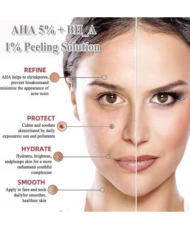 AHA 5% + BH_A 1% Peeling Solution Smooth Skin Exfoliating Facial Serum -Acid Serum For Acne Blackheads & Open Pores Blackhead Remover Reduces Excess Oil & Bumpy Texture 32ml  - Buy Online on SooperMarket.com