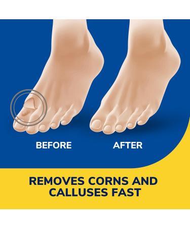 Dr. Scholl's Liquid Corn & Callus Remover - Buy Online on SooperMarket.com
